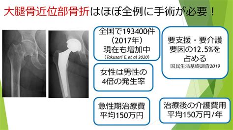 骨枯手術費用